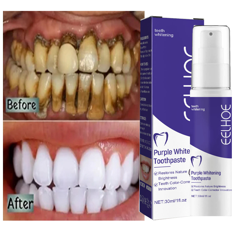 Teeth Whitening Korea - 1 шт. зубная паста для Очищающая,