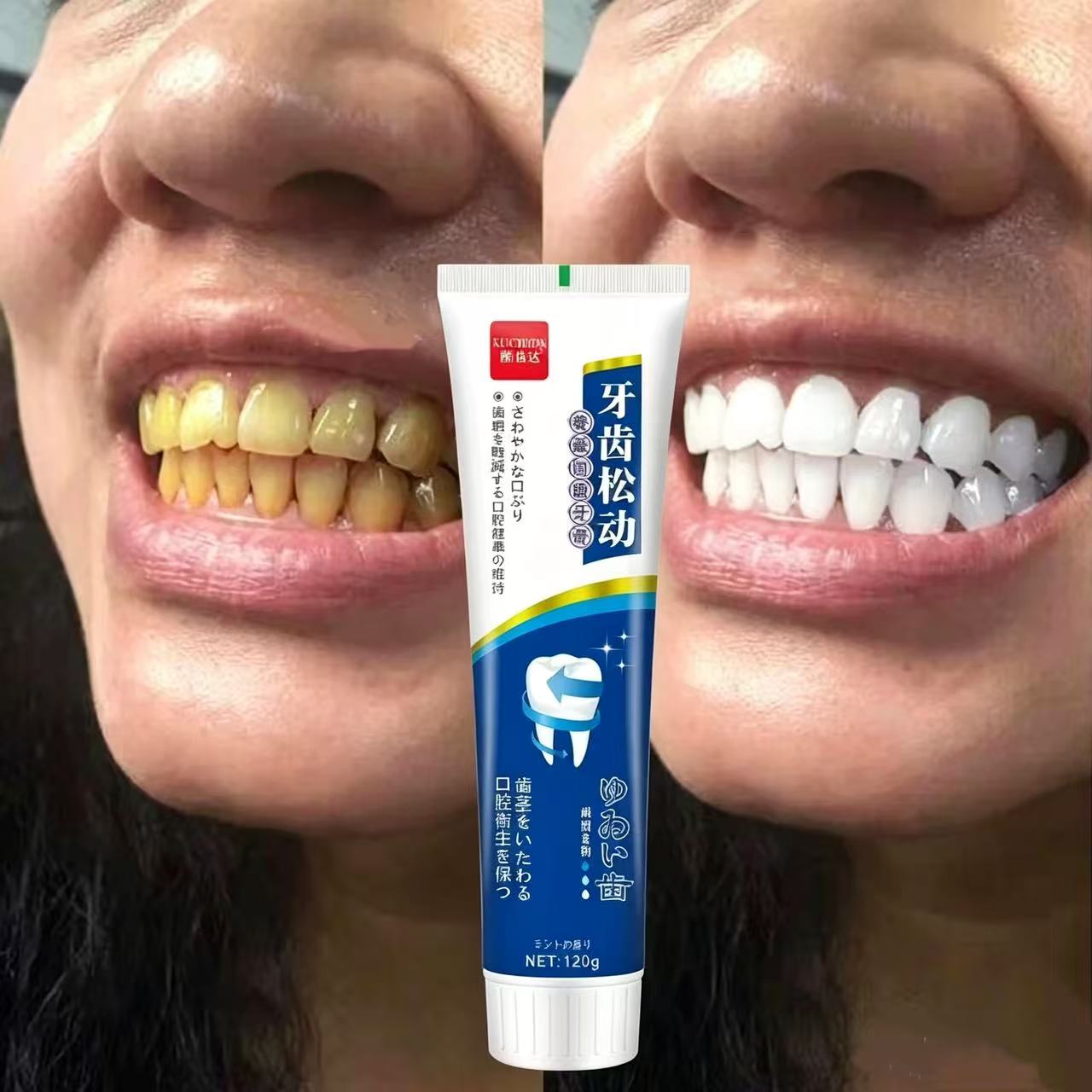 Японская импортная зубная паст – обзор и цена Teeth Whitening Japanese