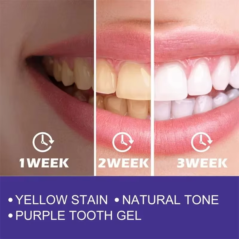 Очищение зубов, отбеливающая з – обзор и цена Teeth Whitening Korea