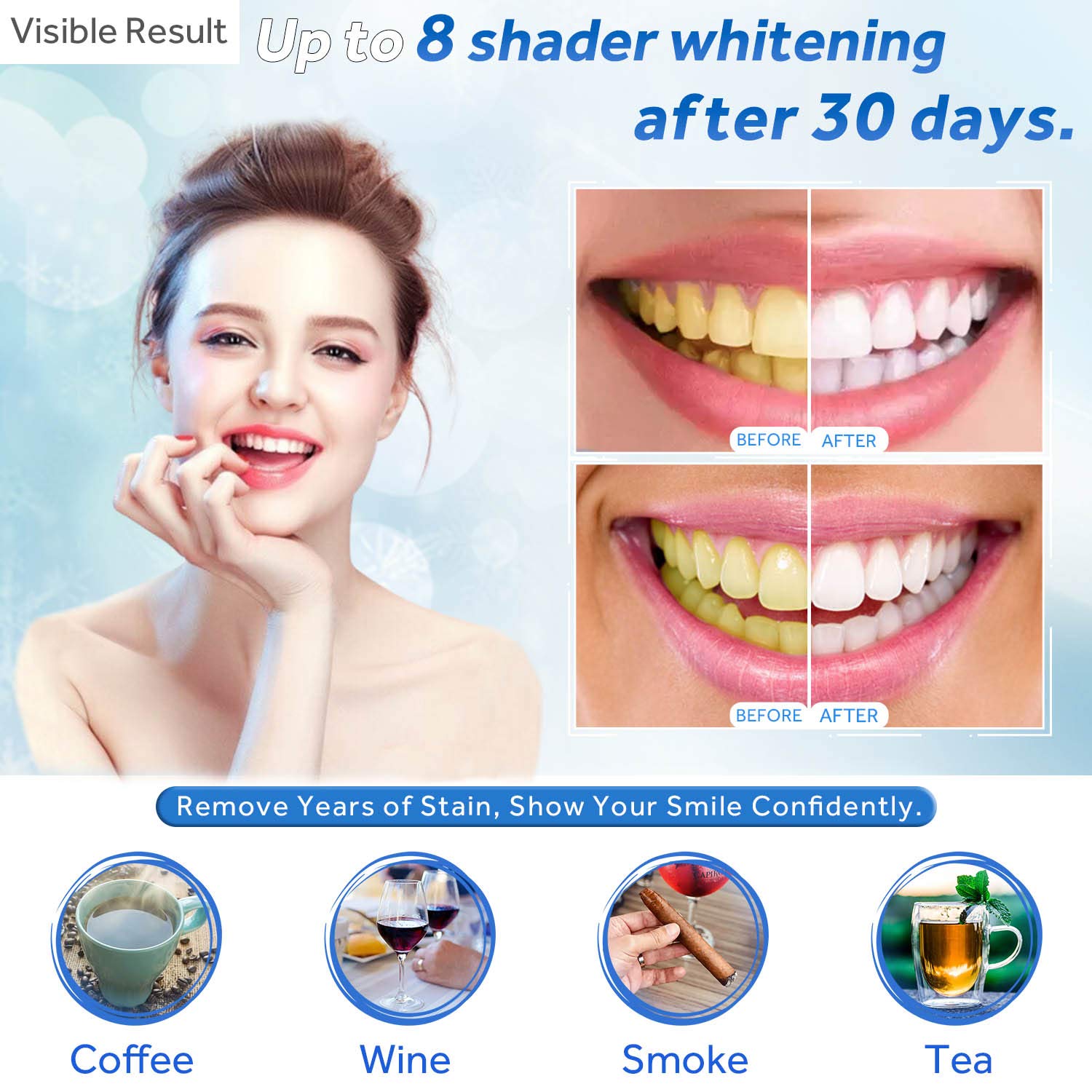Гель для отбеливания зубов, шп – обзор и цена Teeth Whitening Procedure