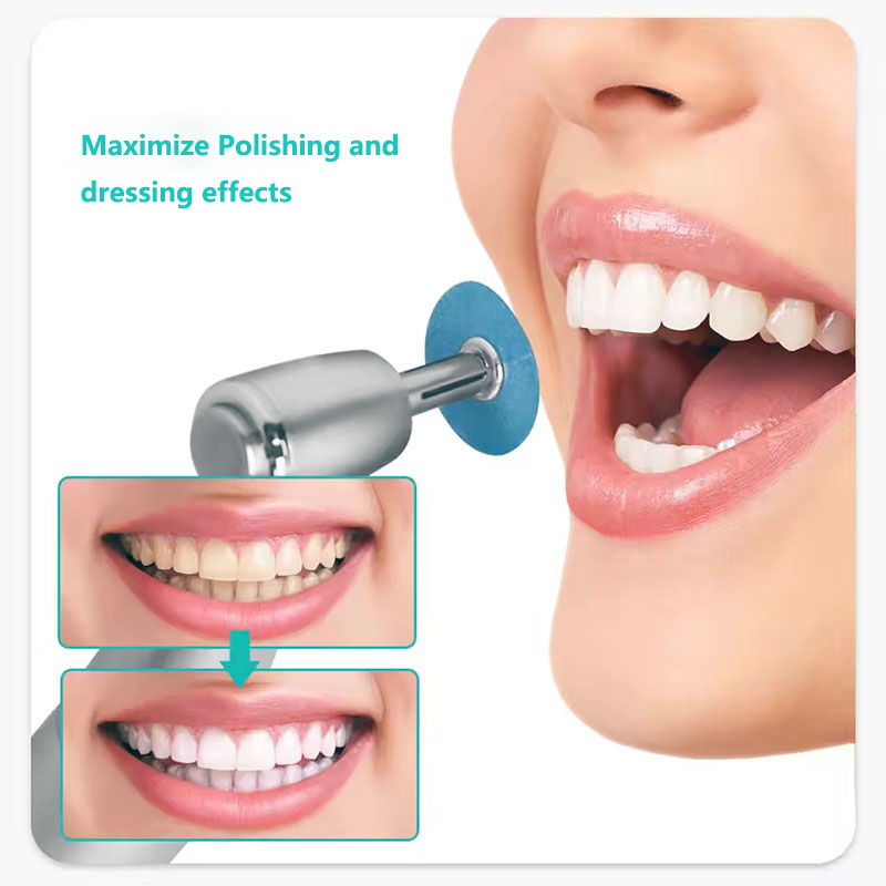 40 шт., стоматологические поли – обзор и цена Teeth Whitening Home