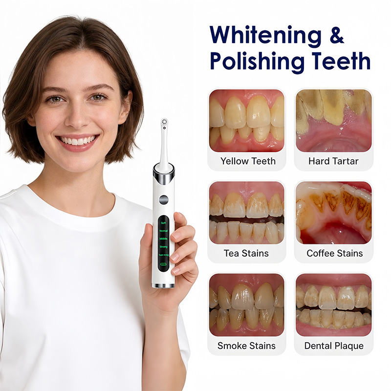 Набор для полировки и отбелива – обзор и цена Teeth Whitening Light Kit