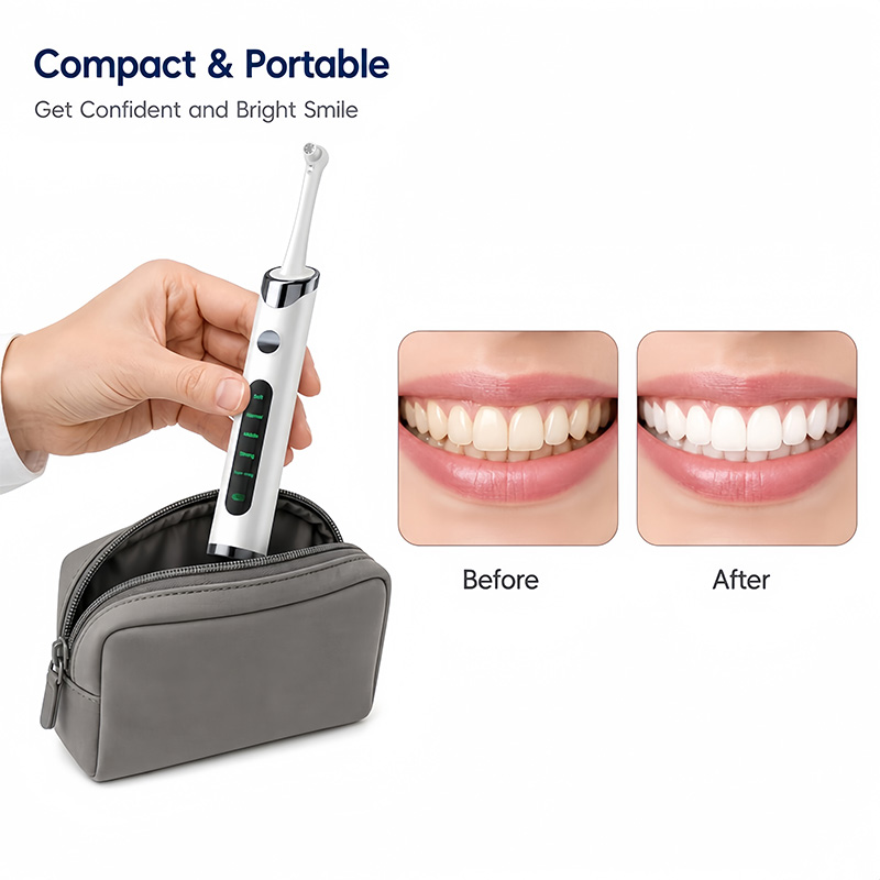 Набор для полировки и отбелива – обзор и цена Teeth Whitening Light Kit