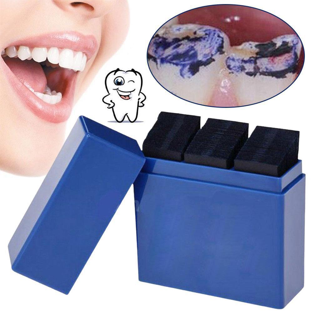 300 листов артикуляционной бум – обзор и цена Teeth Whitening Home