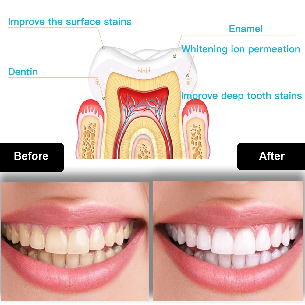 Набор для отбеливания зубов, м – обзор и цена Teeth Whitening Vape